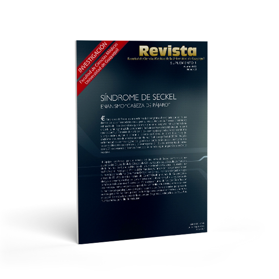 Revista Sindrome de Seckel-